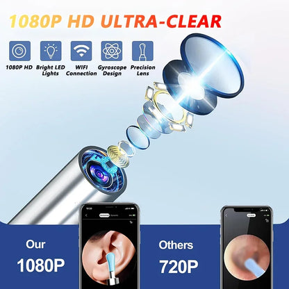 Ear Wax Removal Camera Tool with 5MP HD Endoscope & LED Light