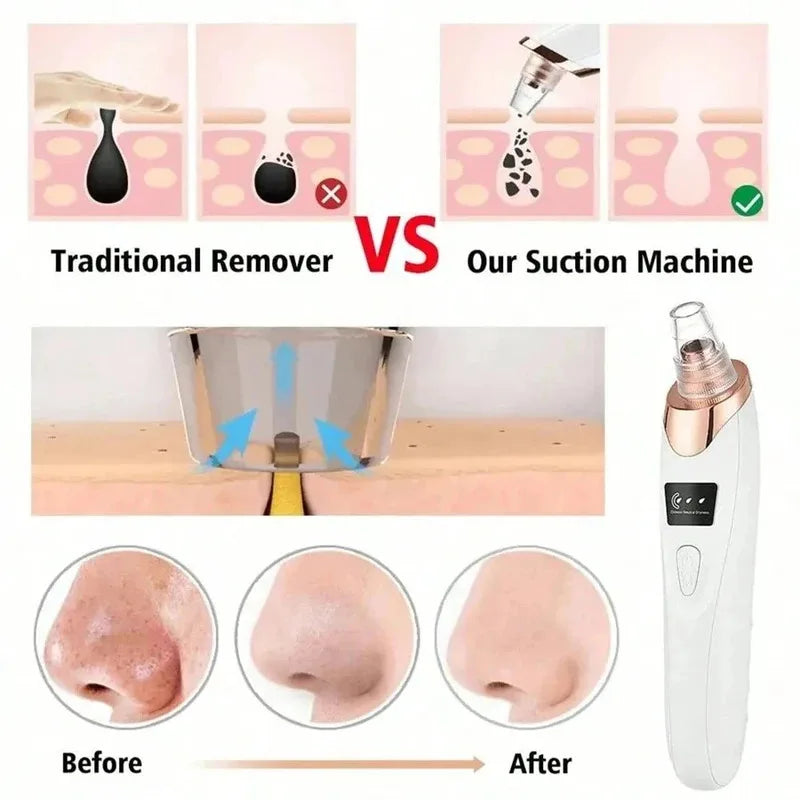 Electric Pore Cleaner Blackhead Remover Vacuum Device Facial Skin Care