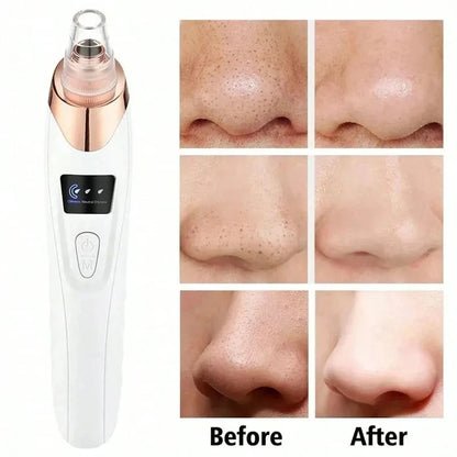 Electric Pore Cleaner Blackhead Remover Vacuum Device Facial Skin Care